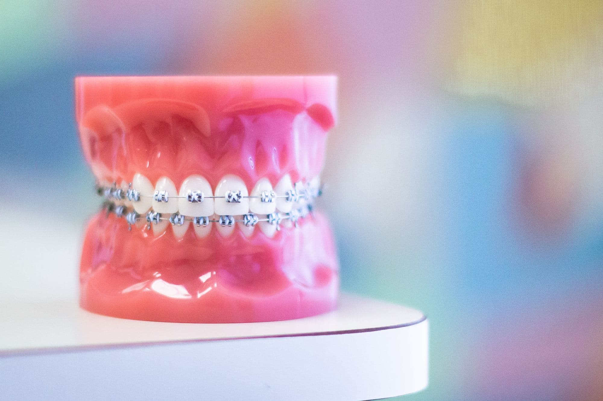 Metal Braces OK