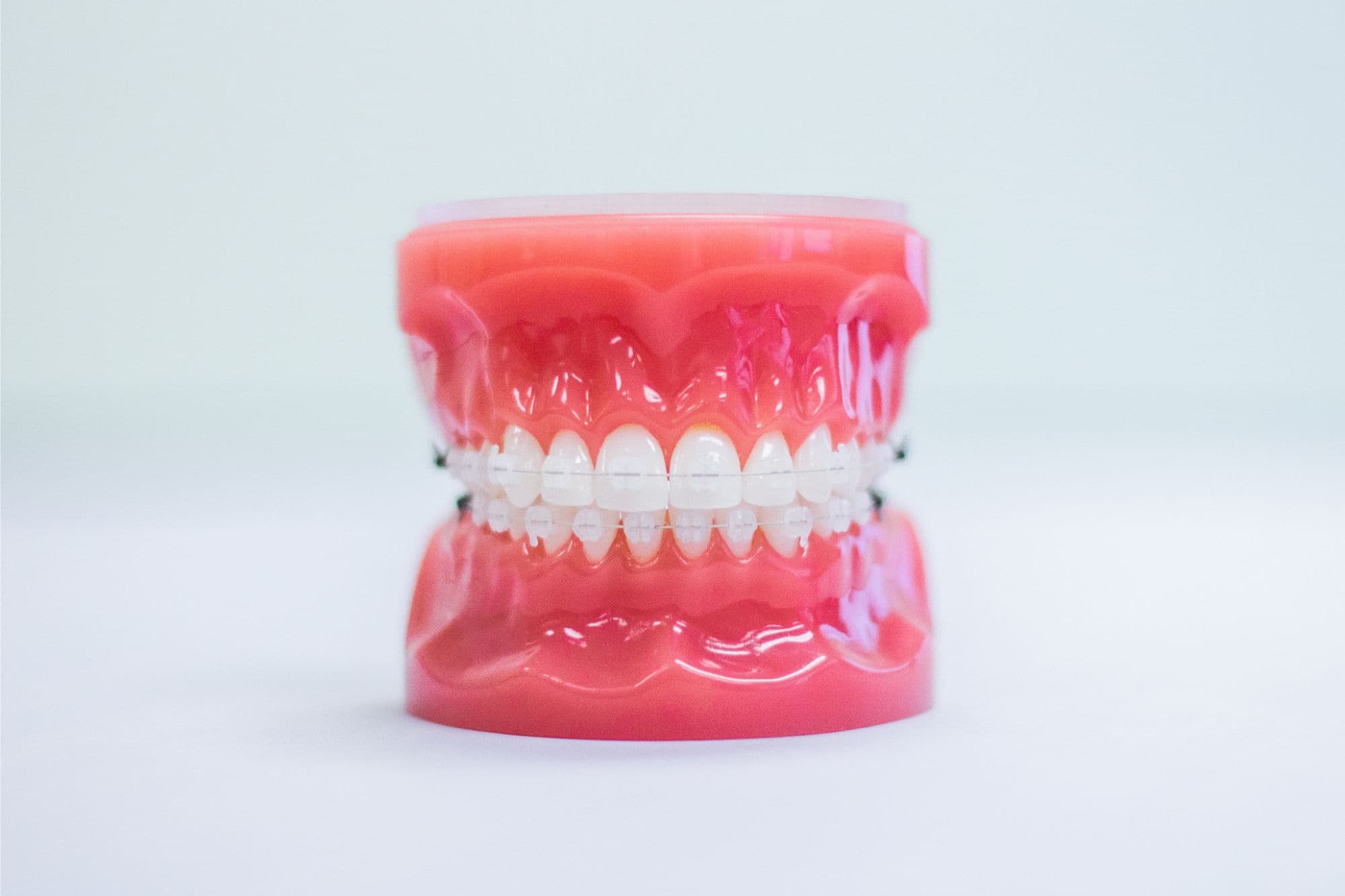 Clear Braces Oklahoma City