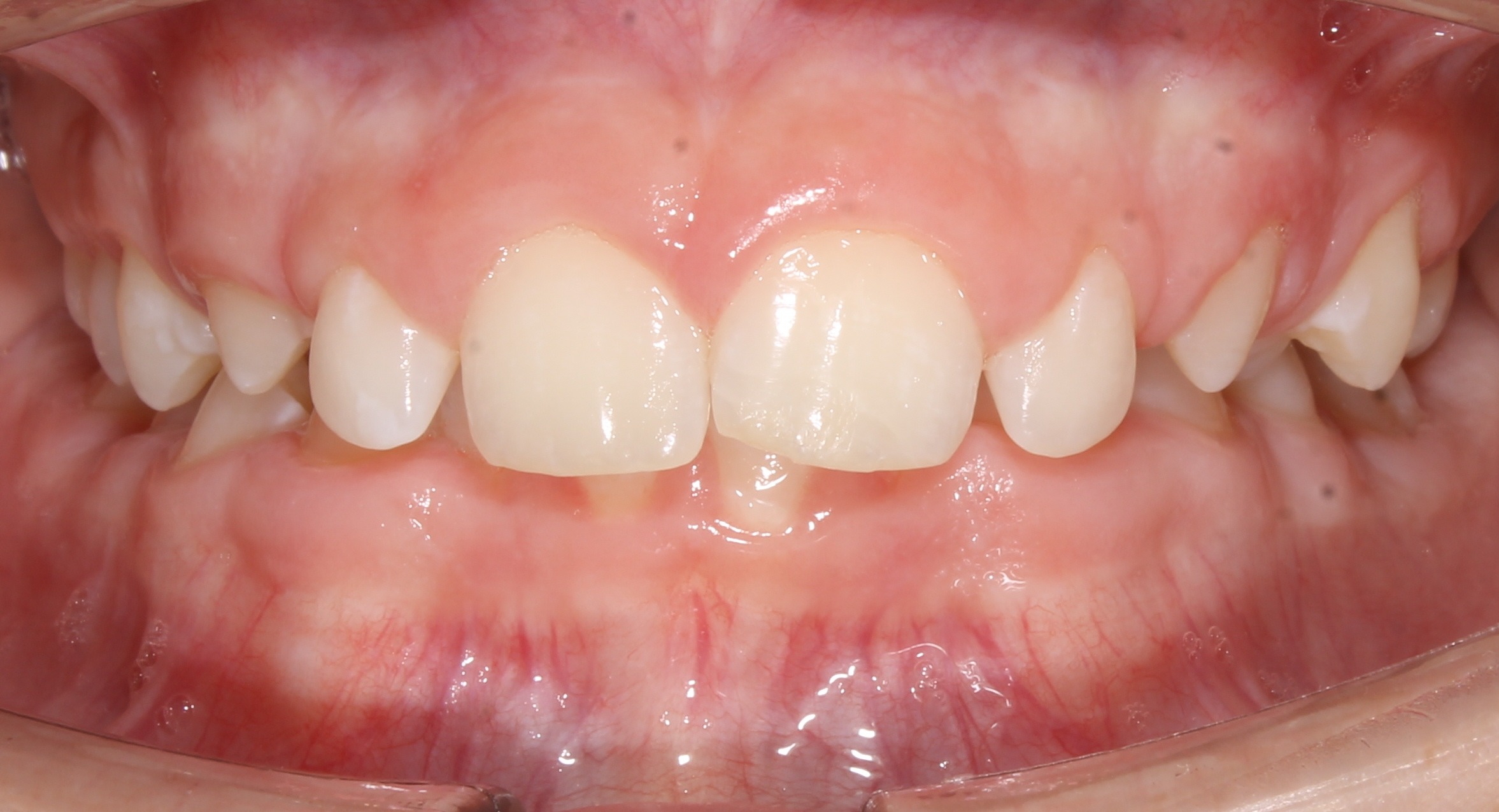 before Image