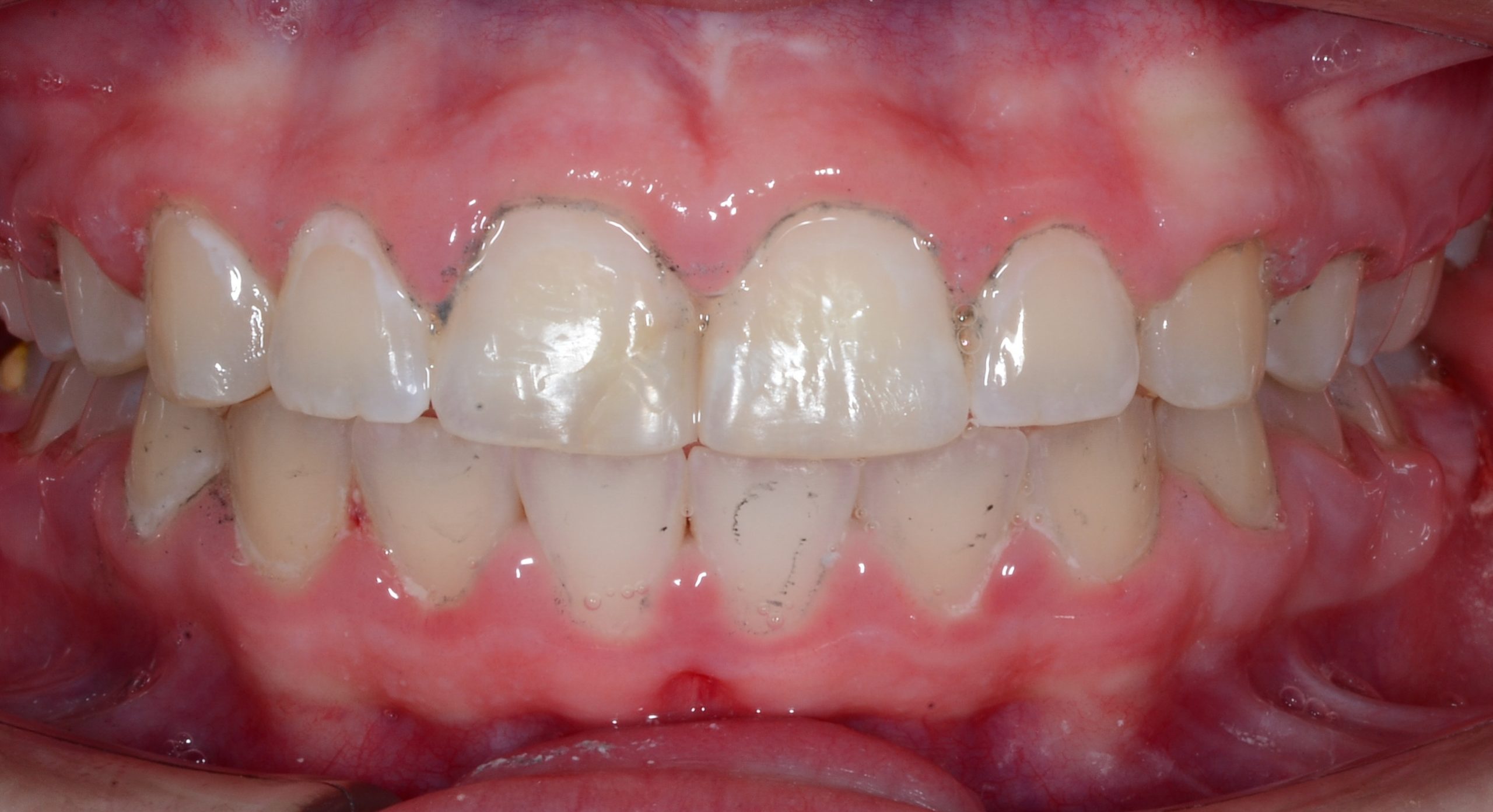 after Image