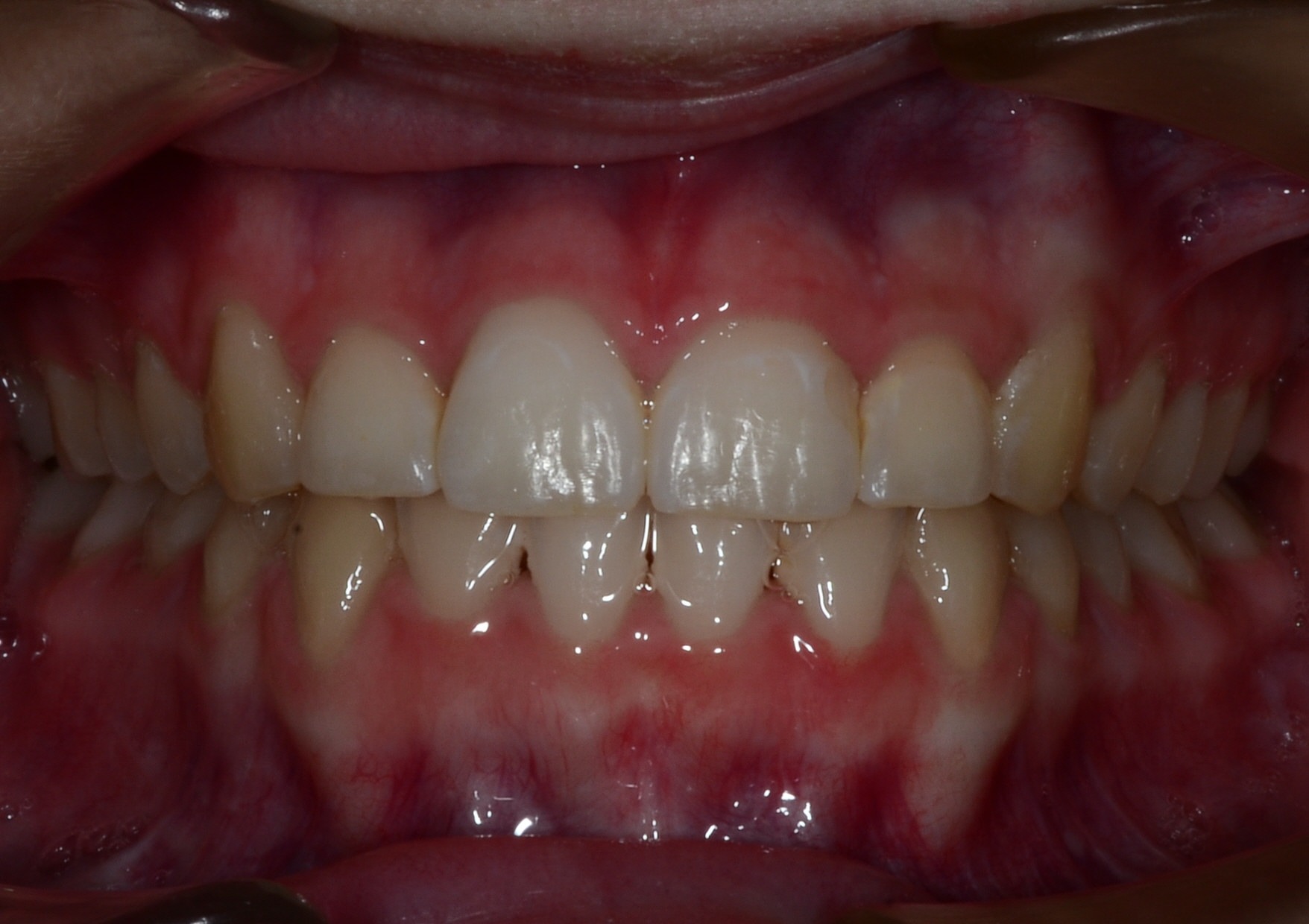 before Image
