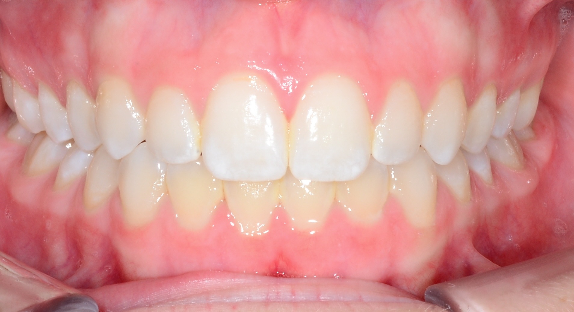 before Image