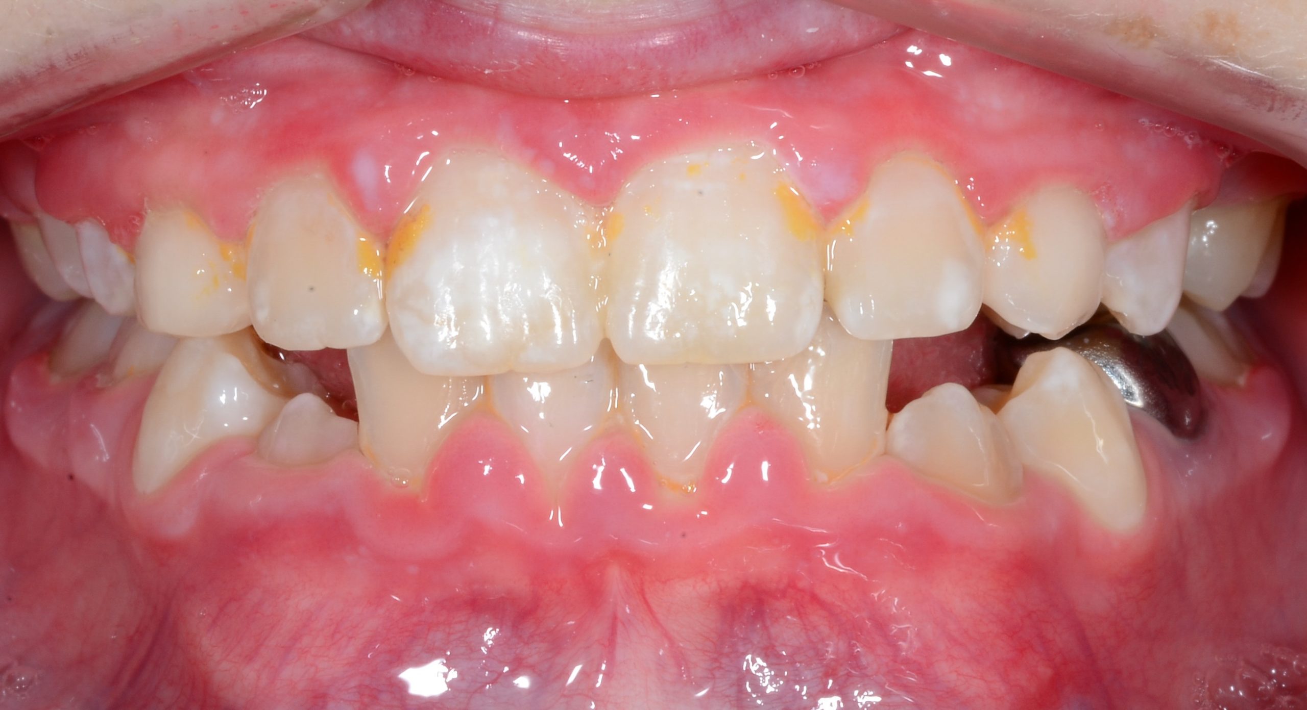 after Image