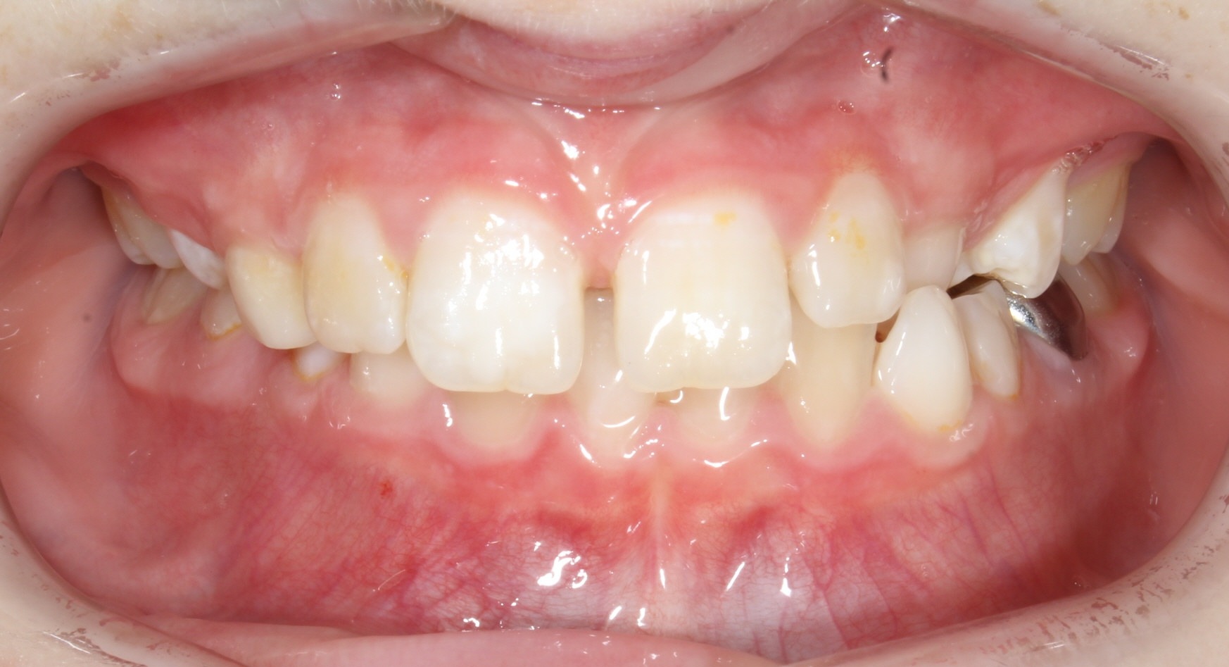 before Image