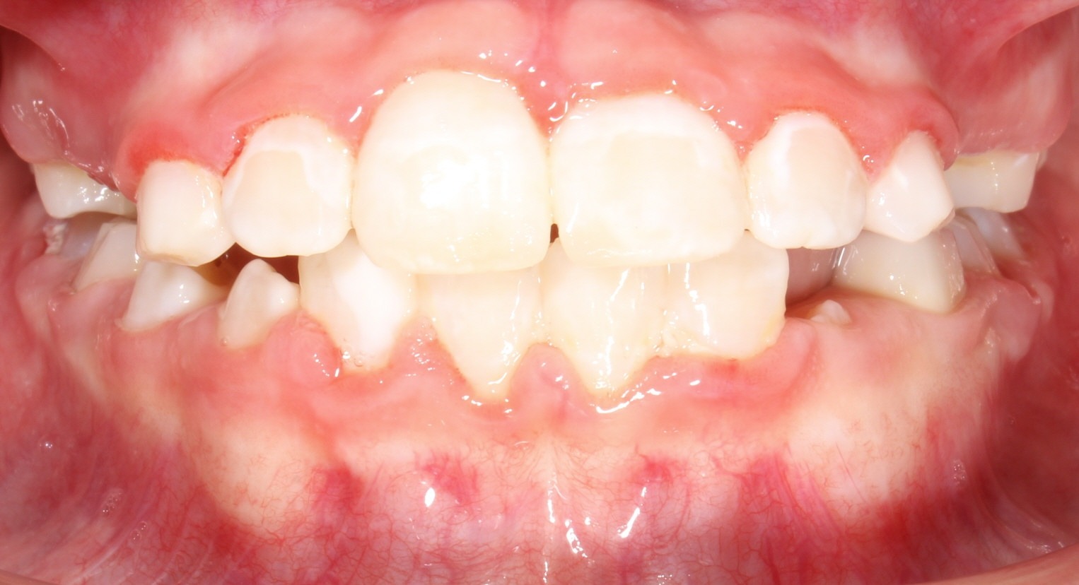 after Image