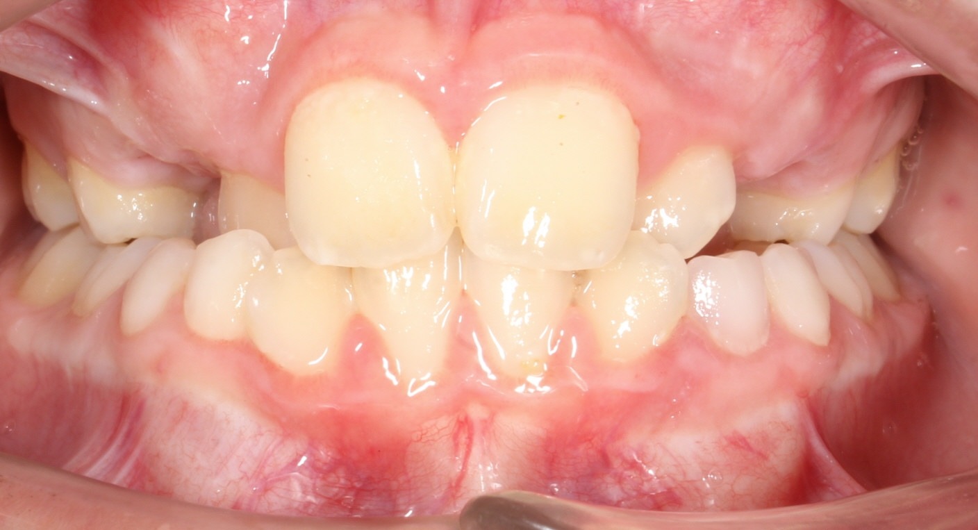 before Image