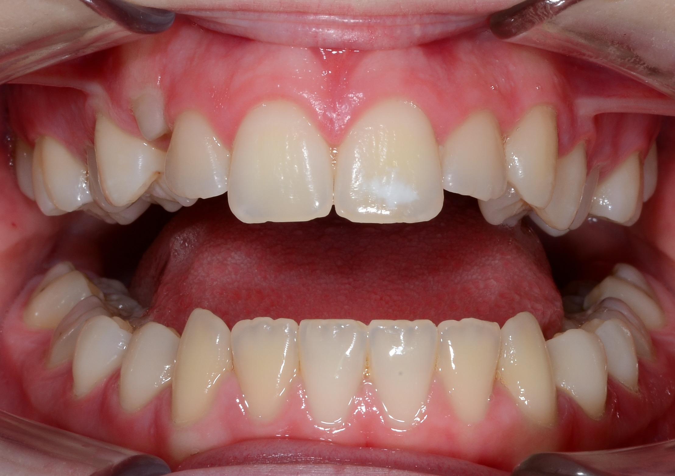 before Image