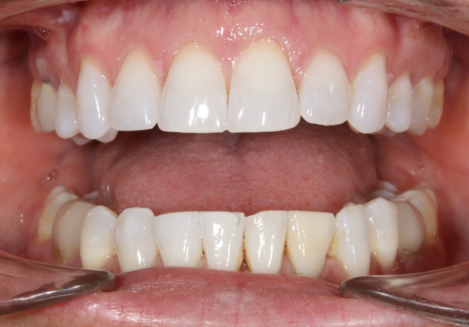 after Image