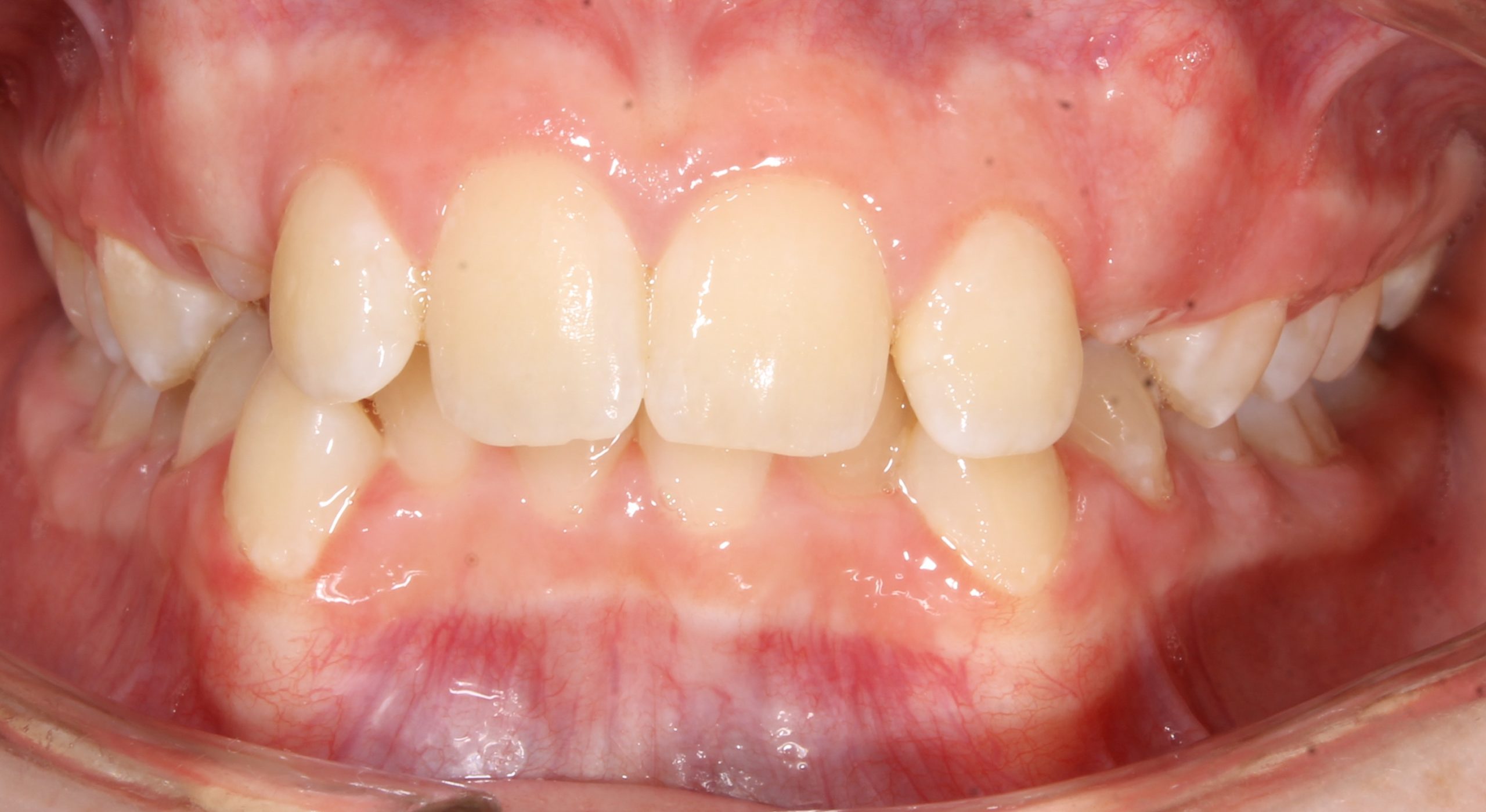 before Image