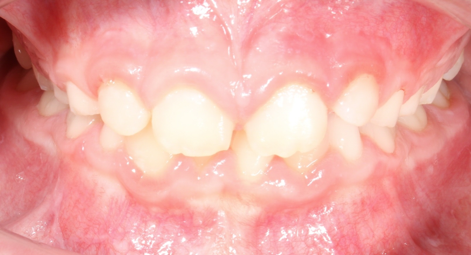 Modified Image
