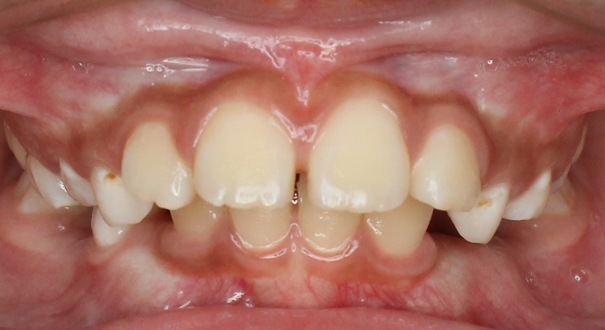 before Image