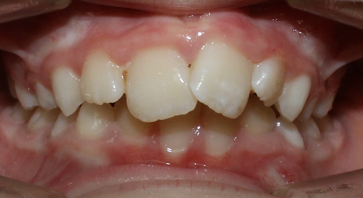 before Image