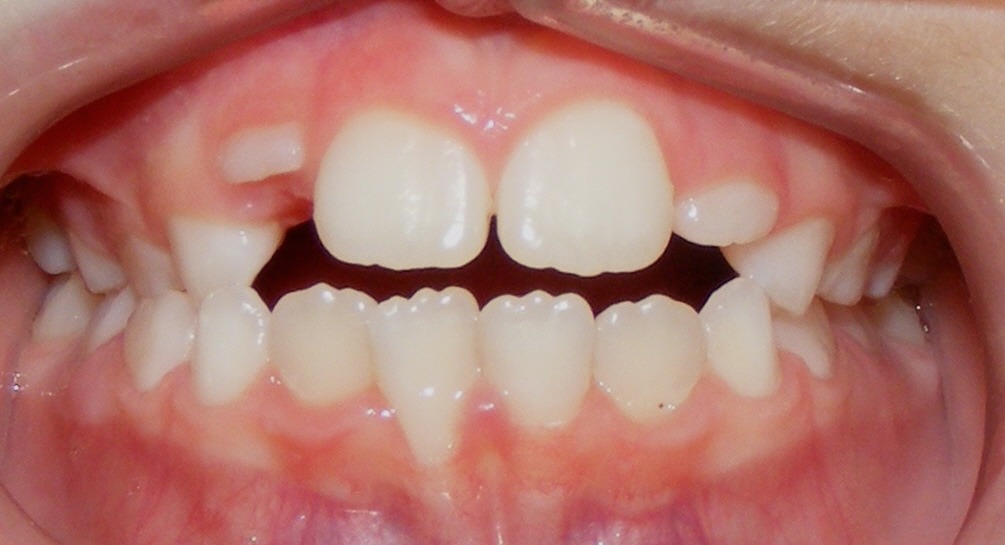 before Image