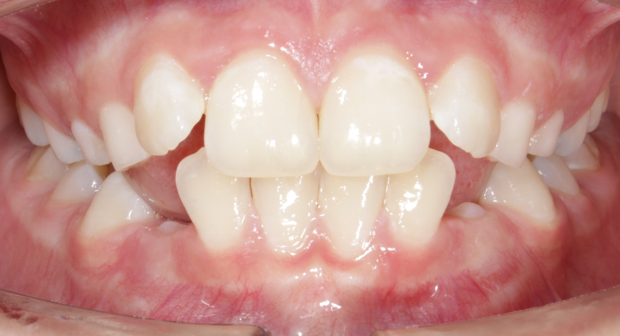 before Image