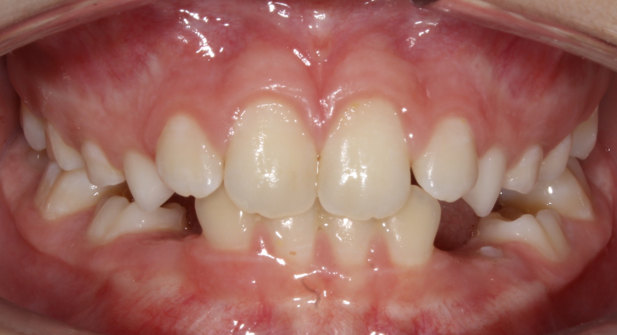 before Image