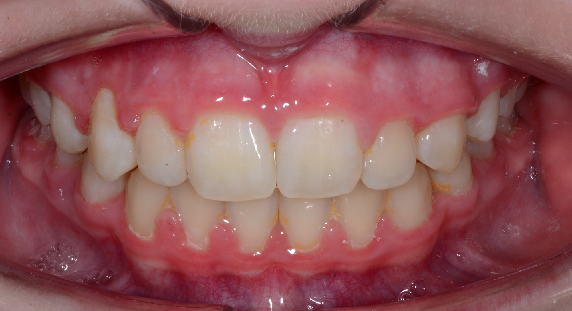 after Image