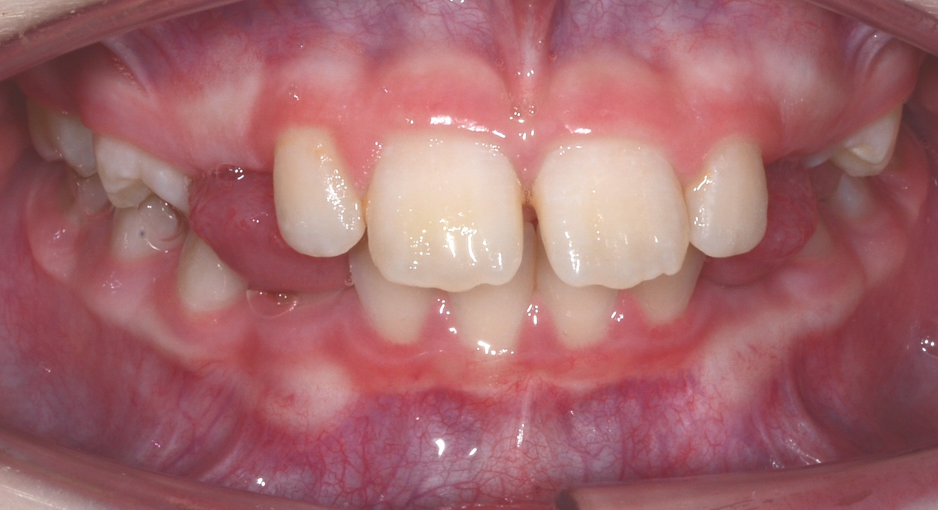 before Image