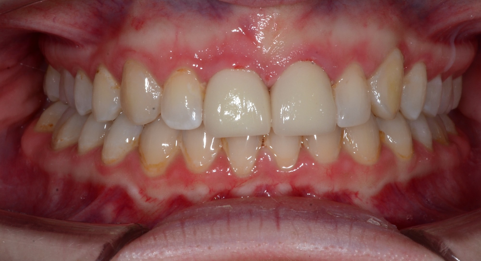 after Image