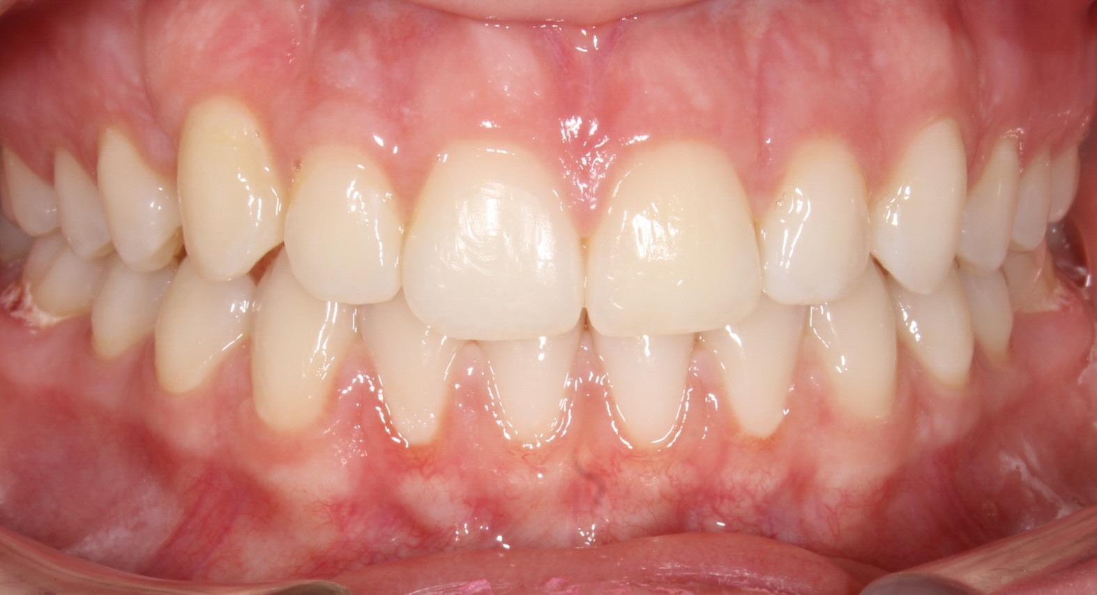 after Image
