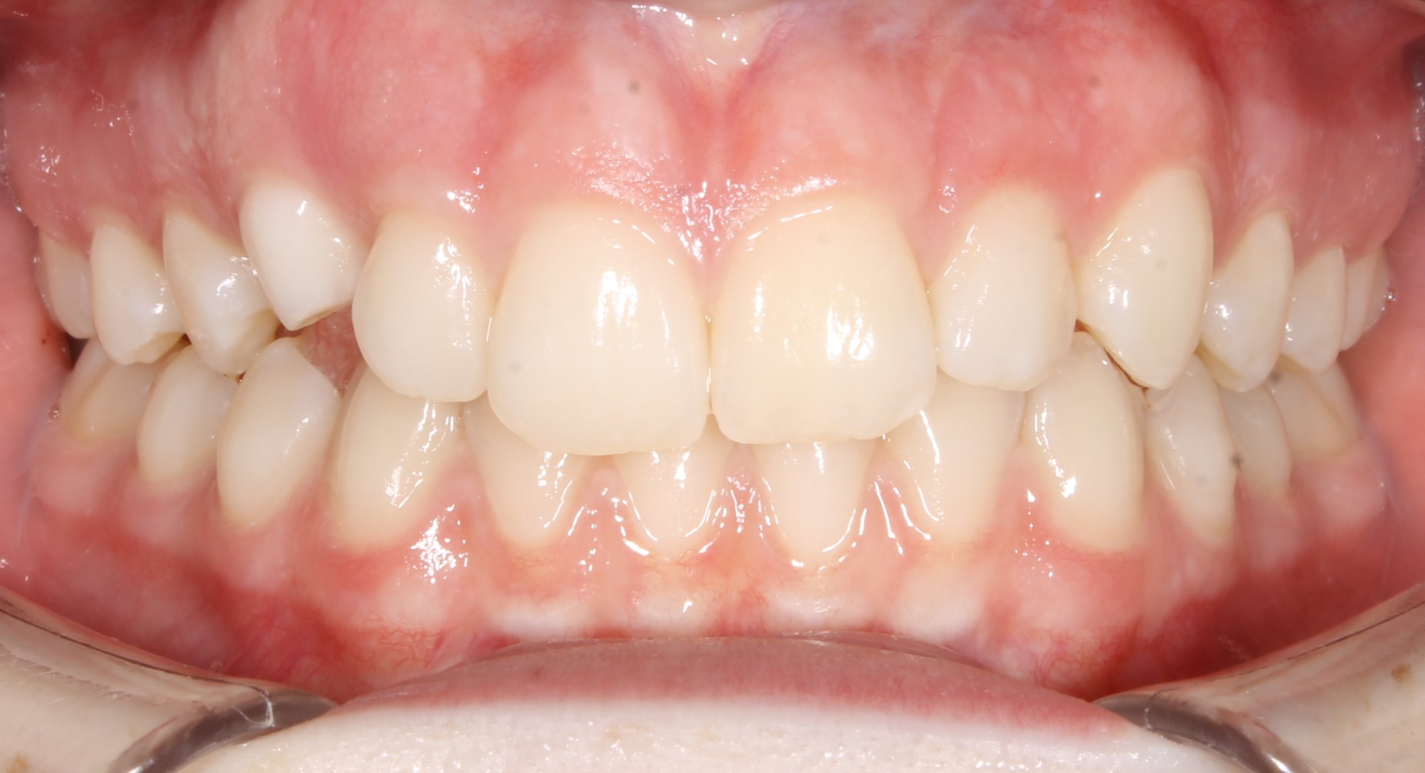before Image