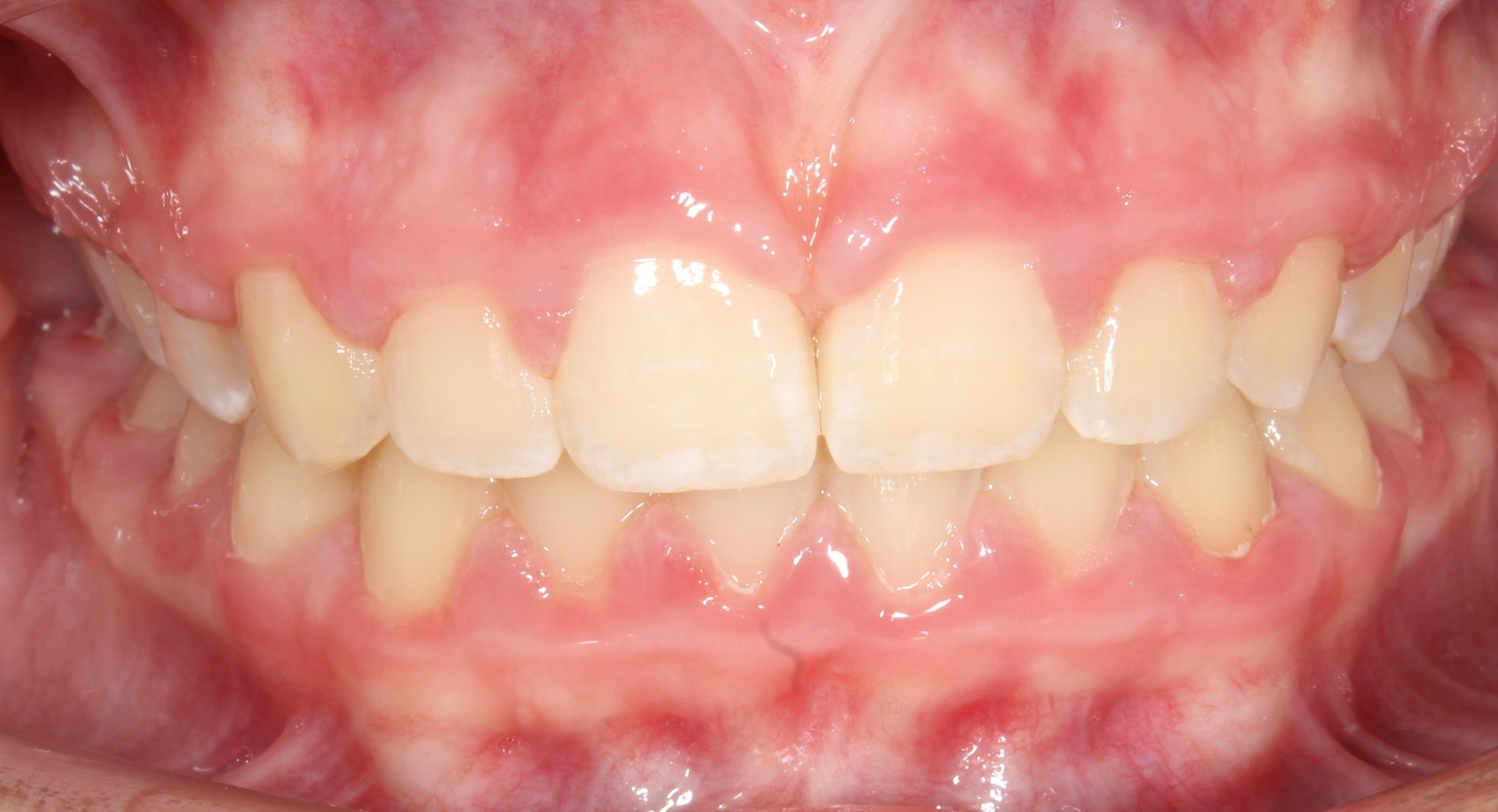 after Image