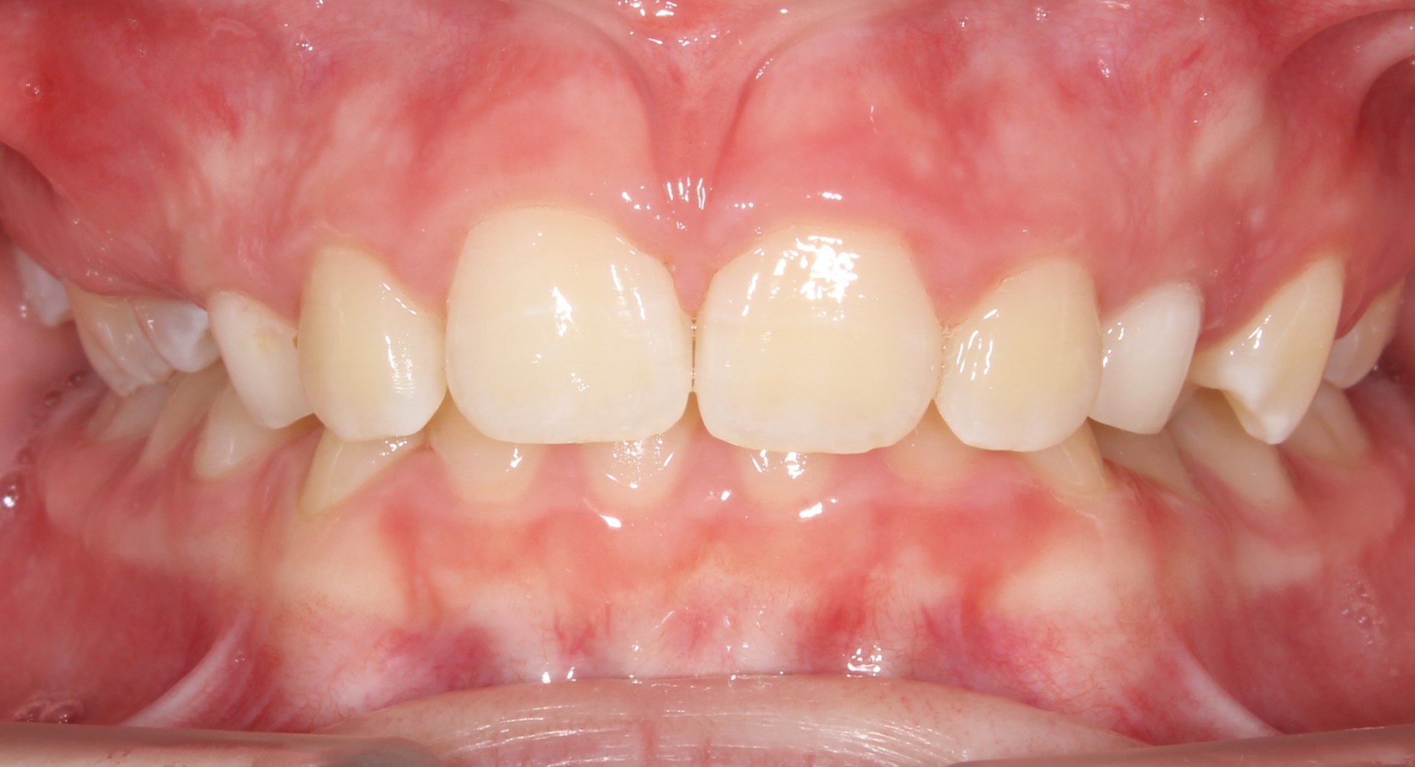before Image