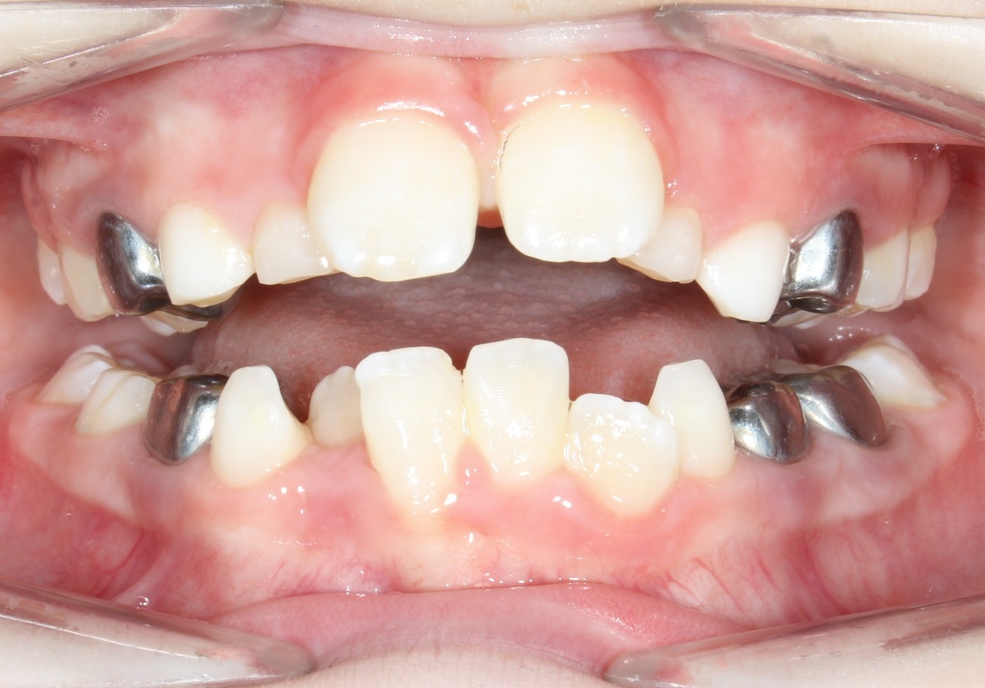 Modified Image